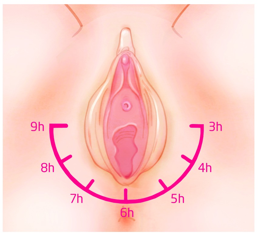 Perineal Massage Application Diagram