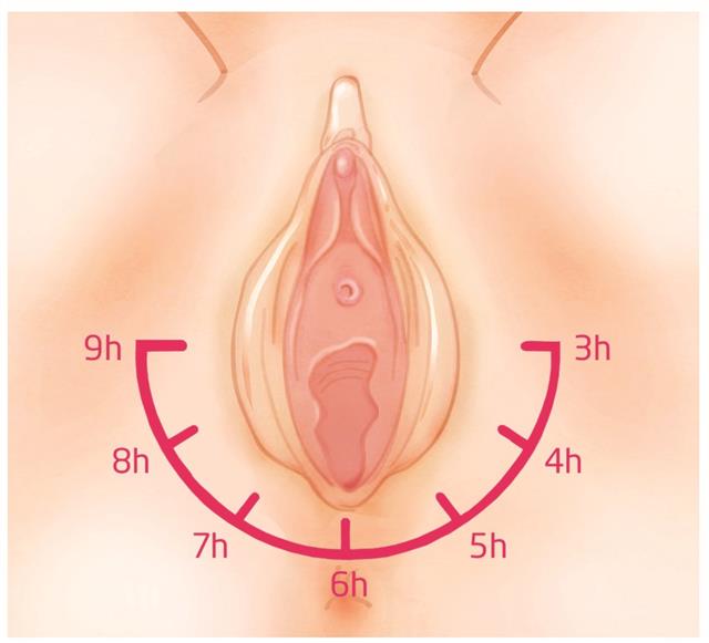 Perineal Massage Why And How To Do It Does perineal massage in pregnancy help all women? perineal massage why and how to do it
