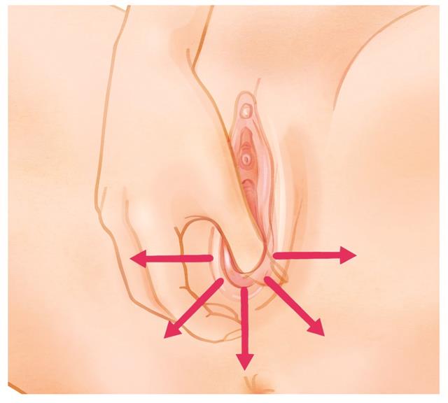 Perineal Massage Why And How To Do It Perineal massage is often done late in pregnancy to help prevent tearing of the perineum during. perineal massage why and how to do it
